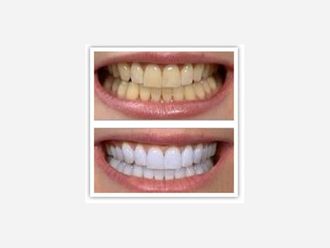 Dentisti-745662