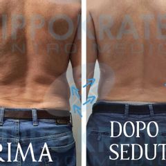 Criolipolisi - Hippokrates Centro Medico Estetico