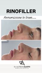 Dr. Alfredo Alioto Rinofiller