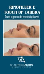 Dr. Alfredo Alioto Rinofiller e touch up labbra