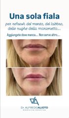 Dr. Alfredo Alioto filler labbra rughe