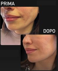 Dott. Fioravante Orefice Botox