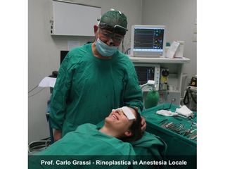 Prof. Carlo Grassi - Rinoplastica in anestesia locale