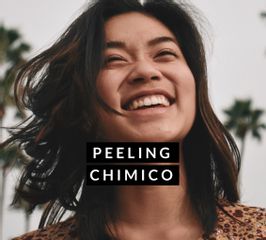 Peeling Chimico