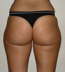 Culotte de cheval pre
