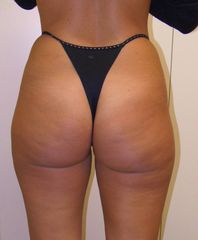 Culotte de cheval post