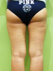 Gambe post