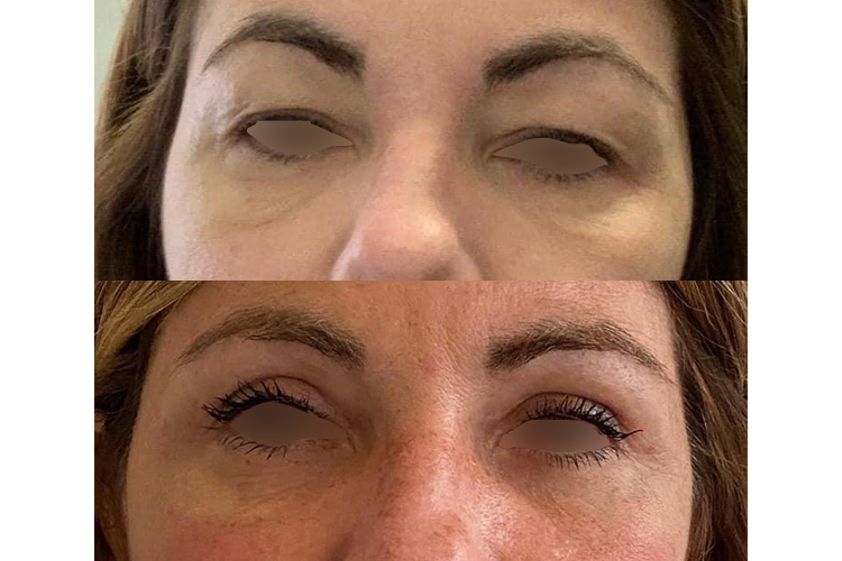 Microblading prima e dopo - 771812