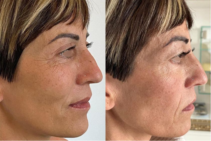 Microblading prima e dopo - 771815