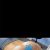 Gluteoplastica +lipofilling a Milano Dott. Ivanildo Tome' De Arruda Filho
