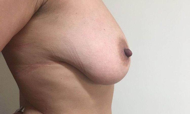 100613