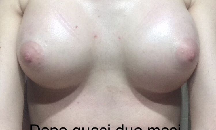 102071