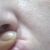 Bolla con puntino bluastro al centro interno labbro