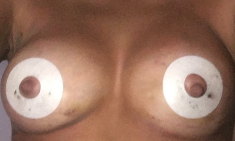 100718