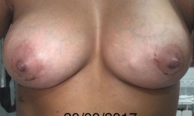 100881