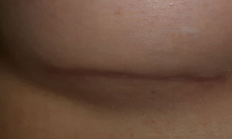 104625