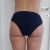 Un mese post liposuzione ad Ancona con la Dott.ssa Marika Langella