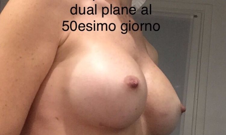 104315