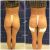 Gluteoplastica: la soluzione che cercavo da anni a Lugano a LaCLINIQUE of Switzerland®