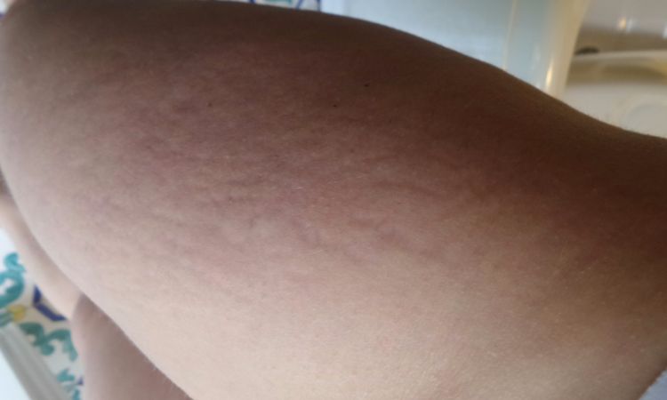 98790
