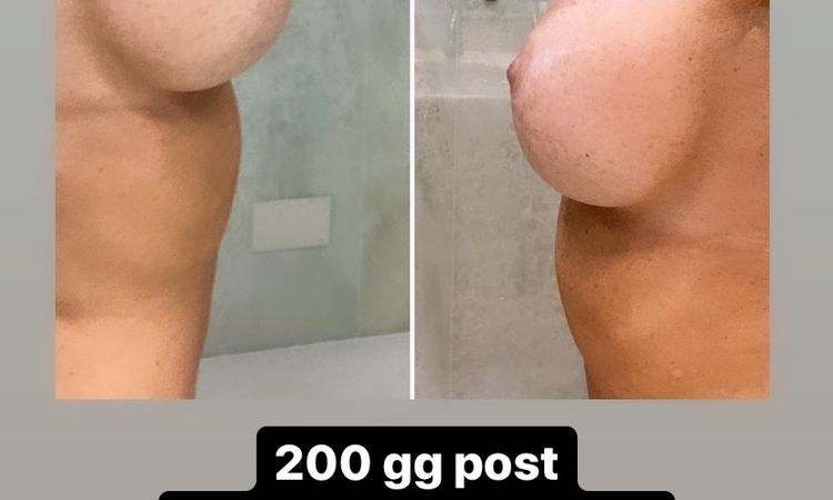 105664