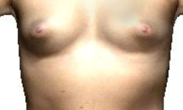 107556