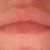 Gonfiore esterno labbro normale o tecnica non adeguata?