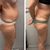 Liposcultura- impeccabile e disponibilissima