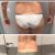 Liposcultura- impeccabile e disponibilissima