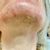 Depilazione laser- nuovo trilaser fantastico!