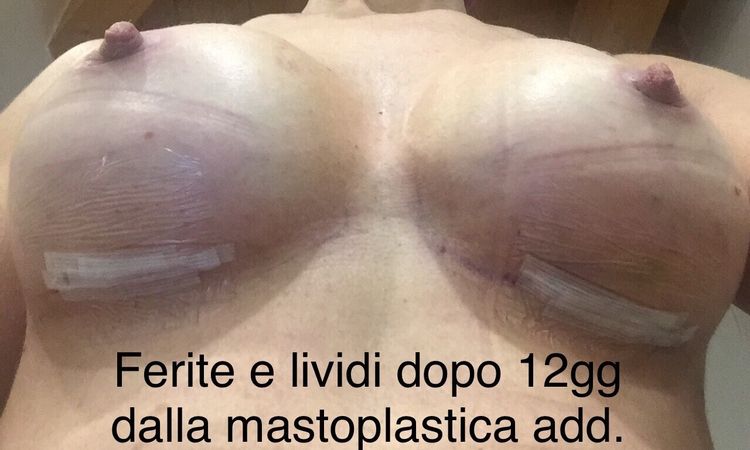 104032