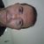 Quarto giorno post lifting del viso a Udine con Dott.Nicola Panizzo