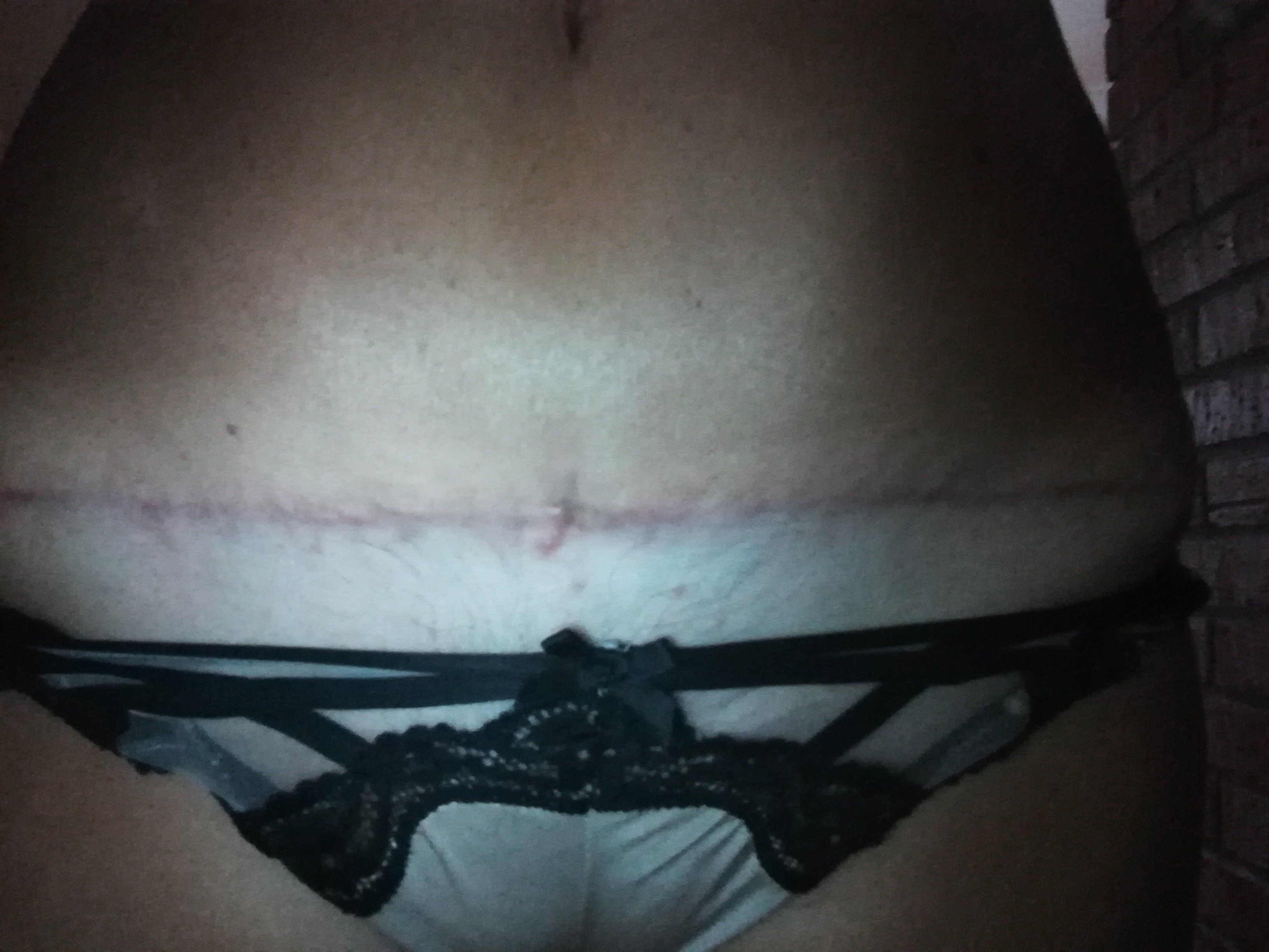 24865