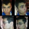 Chirurgia plastica viso