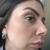 Che trattamento mi consigliate?