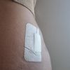 Atrofia del tessuto adiposo