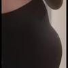 Lipolaser system oppure liposcultura con jplasma (con una zona in meno) 