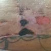 Necrosi post mastopesi+mastoplastica additiva