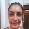 Faccia bloccata da botox/filler