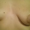 Un nuovo seno in arrivo 