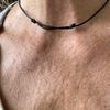 Filler acido Ialuronico decolté