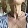 Filler acido Ialuronico decolté