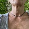 Filler acido Ialuronico decolté