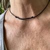 Filler acido Ialuronico decolté