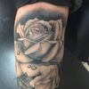 Ipercromia post rimozione tattoo
