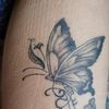 Rimozione tatuaggi: rimarrá cicatrice dell'ago del tatuatore?