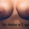 Aggiornamento dopo 18 giorni dalla mastoplastica