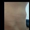 Sono una ragazza di 23 anni e ho il pomo d'adamo