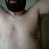 Post operatorio ginecomastia 11 mesi