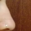 Quanto costa una Rinoplastica parziale?